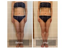 ラシェリー(La Cherie)/ビフォーアフター