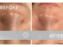 レゴリス 横浜店(REGOLITH)/