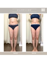 カリスボーテ 関本店/インパクト×RF