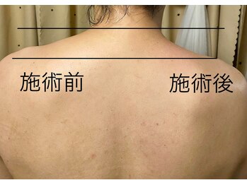 ルリアンデュレ(le lien durer)