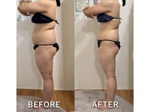 ベルフルール 浜松中野町店/セルゼロ痩身全身２回目