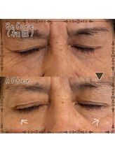 プライベートサロン レイ(Ray)/カスタマイズコース目元シワ改善