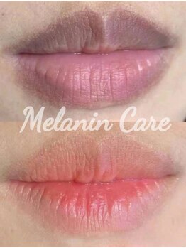 ペキュリア 恵比寿店(PEQLIA)/最新の黒ずみケアで唇ケア♪