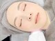 エヌココ(N_coco)の写真/【本気の肌質改善】韓国で大注目の"サーモグロウリフト"でお肌のお悩みを根本から改善♪小顔効果も◎