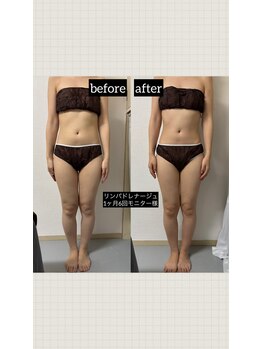 トゥルーミー(True Me)/ボディライン気になる方