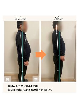 スズラン(SUZURAN)/DRT背骨調整後の変化