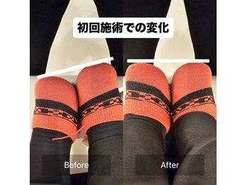 寿 上野院(KOTOBUKI)/整体/上野/肩こり/上野整体