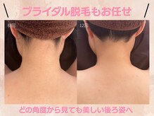 ルミエールブランシュ(Lumiere blanche)の雰囲気（《ブライダル》デザインあり脱毛もおまかせください◎）