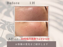 トータルビューティー雅/お肌のキメ整います！