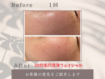 トータルビューティー雅/お肌のキメ整います!