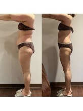 シューラディアント(ShuRadiant)