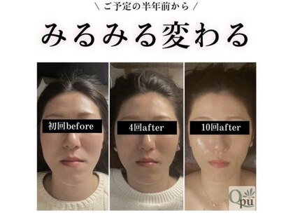 キュープ 大阪中百舌鳥店(Qpu)の写真