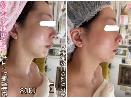 アルページュ(Arpege)の写真