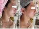 アルページュ(Arpege)の写真