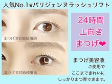 ポコ(POCCO)の雰囲気（お得な美容液付きクーポンもご用意中）