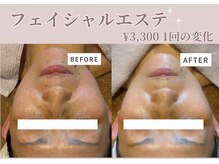 メナードフェイシャルサロン 中区平和