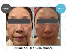 アンプリール(emplir)の雰囲気（【ドクターピュアラボ】認定サロン肌質改善、たるみ、しわ）