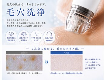 サロンスペース 新浦安店の写真/【毛穴の黒ずみ・詰まりを本格ケア♪】毛穴洗浄×選べるクリスティーナピーリング×LDM水玉リフティング