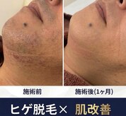 サロンドナーベル(Salon de navel)