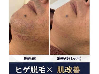 サロンドナーベル(Salon de navel)の写真