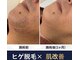 サロンドナーベル(Salon de navel)の写真
