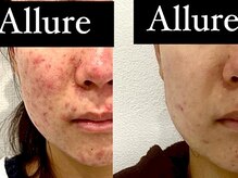 アリュール(Allure)