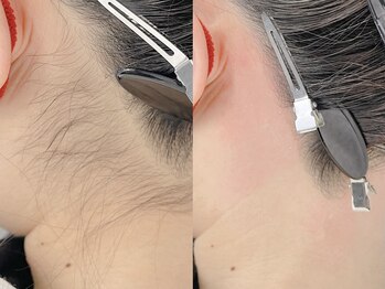 ネリネ 天神(nerine)/うなじWax☆ブライダル脱毛