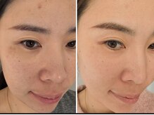 ユミサロン(U Mi Salon)/