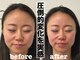 ソラナ(Solana)の写真