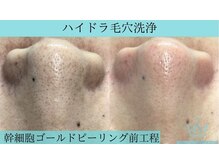 リメイク 広尾(REMAKE)/