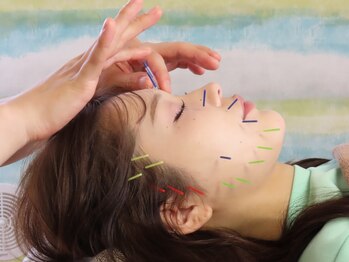 ハウオラ 三軒茶屋(HAUOLA)の写真/【美容鍼初心者も大歓迎◎】肩こり/小顔/むくみを同時に解消しスッキリ☆理想のフェイスラインをGET!