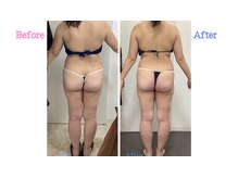 リオンズ 柏駅前店/痩身ダイエット