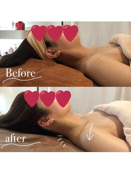 ステライチマルサン(stella.103)/眼精疲労リンパフェイシャル