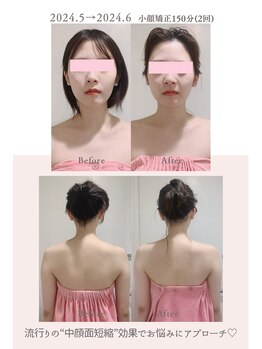 トゥインクル 麻布(twinkle)/南麻布/シンメトリー小顔矯正