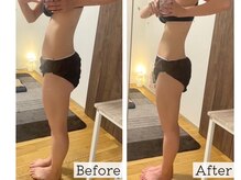 ヨサパーク ブリス(YOSA PARK Bliss)の雰囲気（結果重視◎ぽっこりお腹、下半身痩せ、二の腕、お任せ下さい♪）