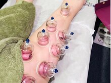 楽癒/カッピング(吸玉療法)