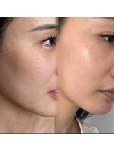 ユミサロン(U Mi Salon)/