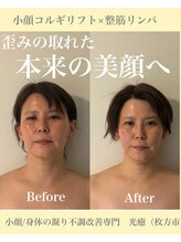 光癒(コウユ)/Before.After
