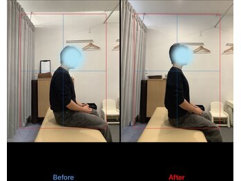 デン整骨院(DEN整骨院)/姿勢矯正/腰痛/U24/学割/宮代