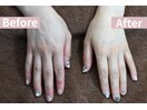【手の乾燥・シワ】が気になる方