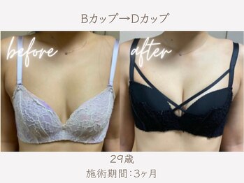 ハリスタ 西宮院(HARISTA)/3ヶ月間でBカップ→Dカップ