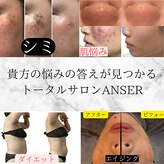 アンサー(ANSWER)