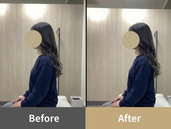 クオーレ(Cuore)/Before After