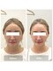 オルネ(ORNE.)の写真/小顔にするのが得意なサロン◇◇小顔フラクショナルと美顔調整の組み合わせがおすすめ◎