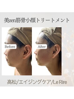 ルリール(Le Rire)/心地いい小顔矯正で究極の小顔！