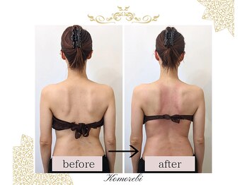 コモレビ(Komorebi)/