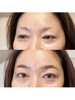 アイリー(IRIE)/HBL＋LASH LIFT＋Facewax