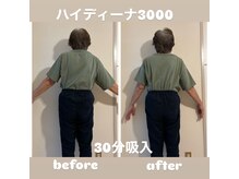 ヨサパーク メリー(YOSA PARK merry)/ハイデイーナ3000 &nbsp;&nbsp;30分吸入