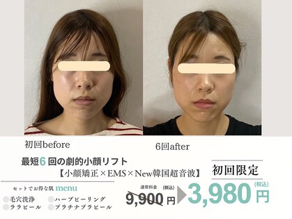 エスポワール(espoir)の写真