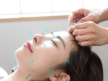 スカイブルー鍼灸接骨院の写真/【ラジオ波×美容鍼×ヒト幹細胞】国家資格者だから実現できる施術で,しわ・たるみ・ほうれい線を本気改善!